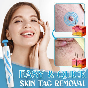 Auto-Micro Skin Tag Remover - ZHOFT